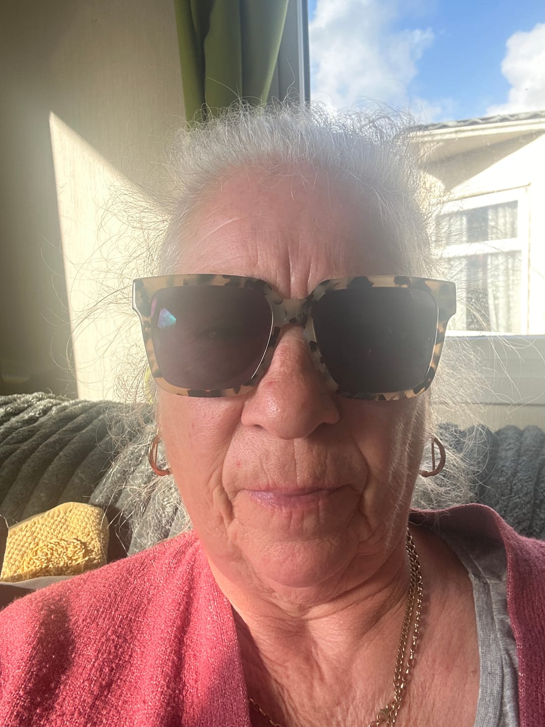 Customer photo review of Lens Replacement