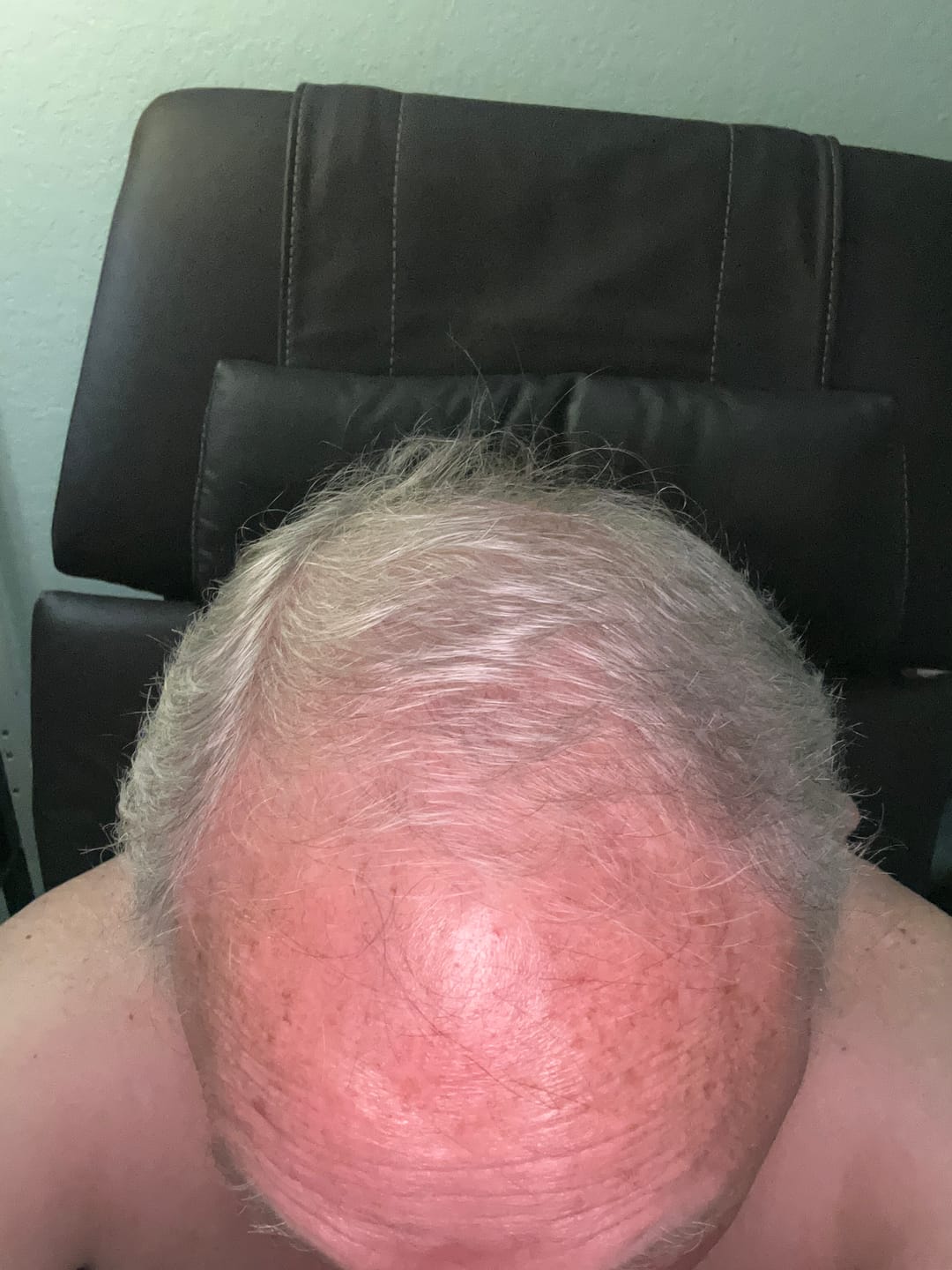 Customer photo review of Spartan™ Root Activator Shampoo 3 Bottles(sc)