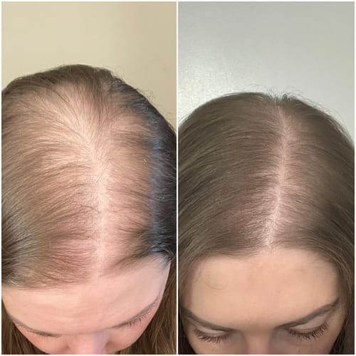 Customer photo review of rosemary & rice water