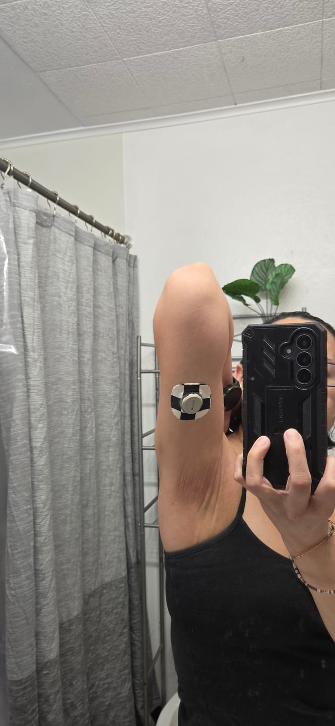Customer photo review of Skin Grip Original - Dexcom G7 & Stelo Adhesive Patches (With Cutout)