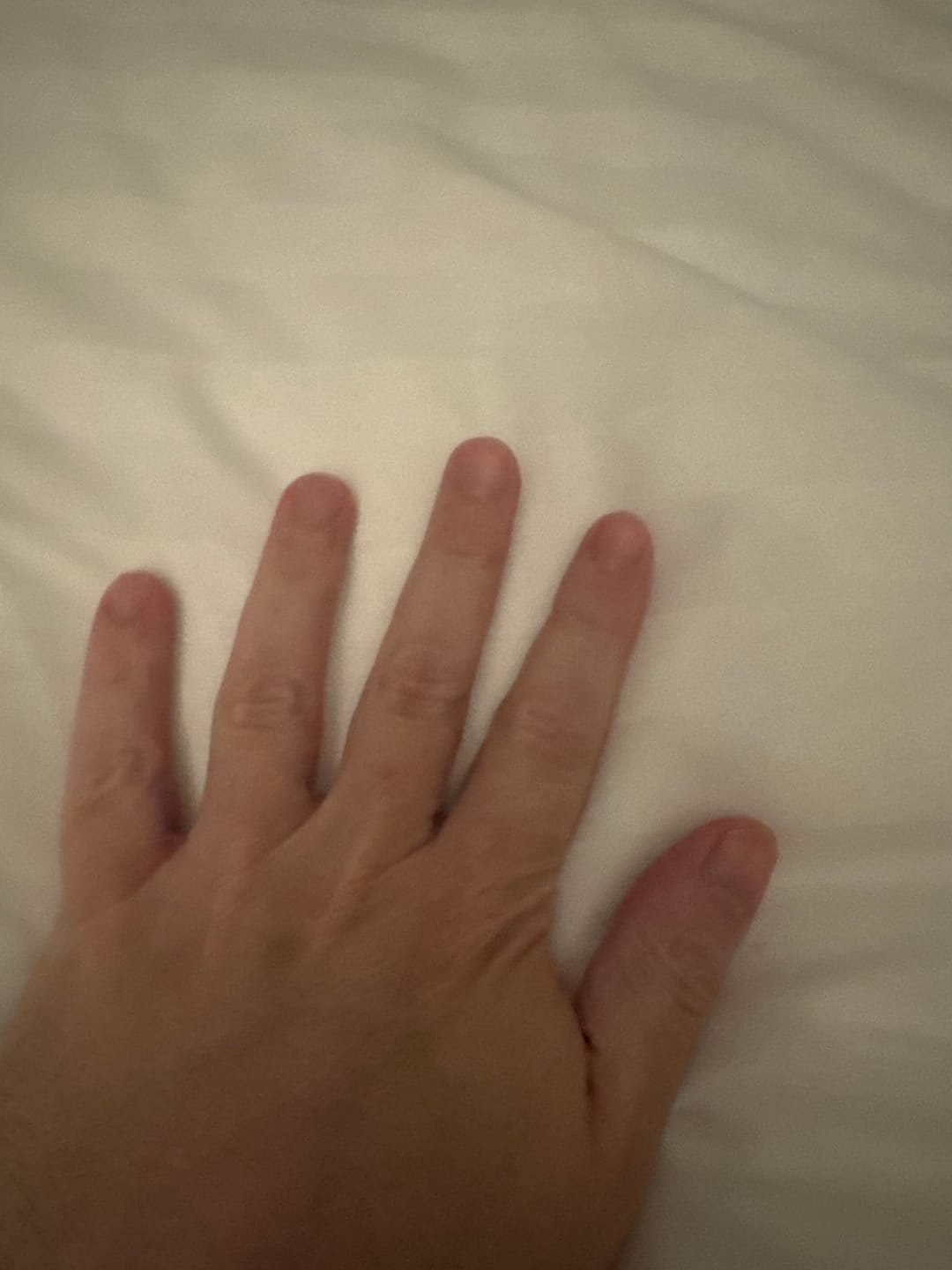 Customer photo review of 30-Day Hand Recovery System