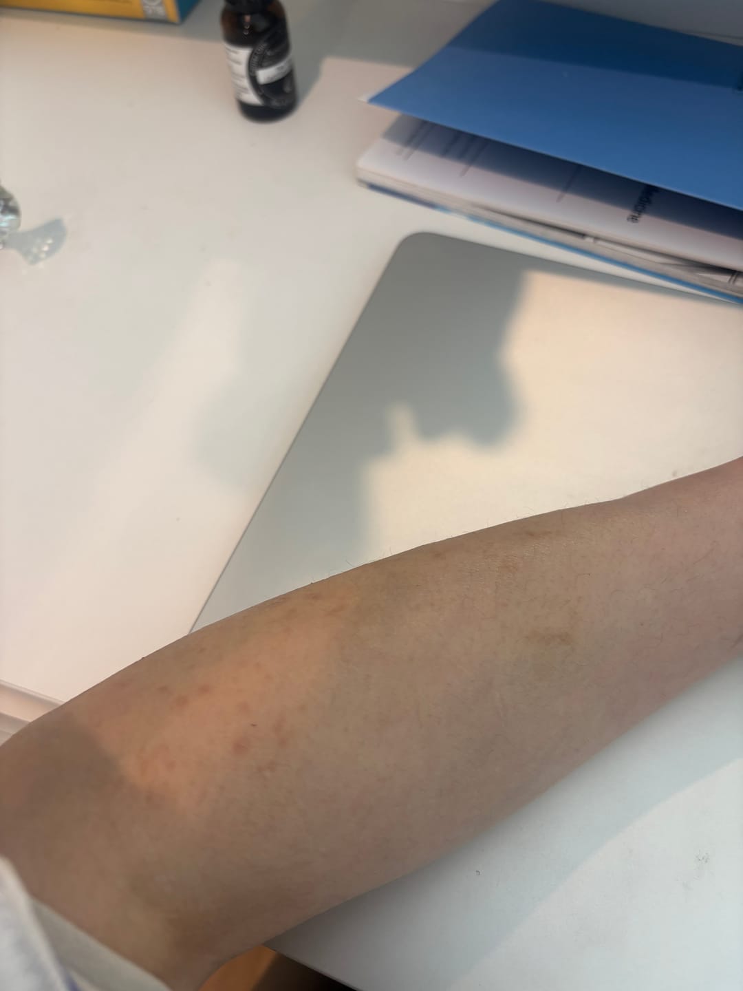 Customer photo review of Sea Cucumber Collagen Calming Cream