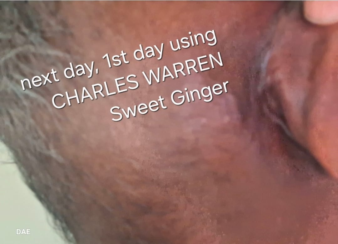Customer photo review of Sweet Ginger Vapor Rub
