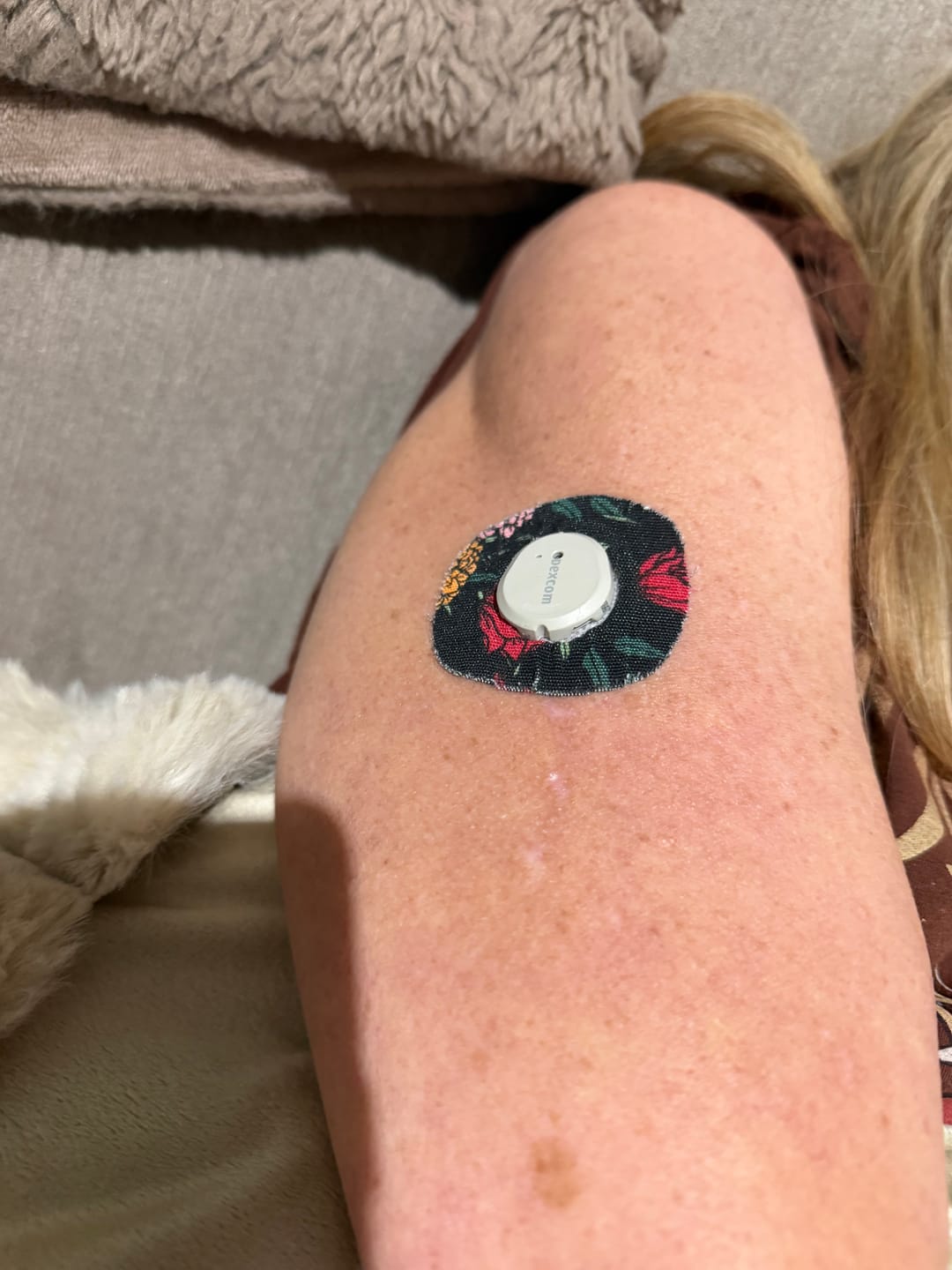 Customer photo review of Skin Grip Adhesive Barrier Wipes