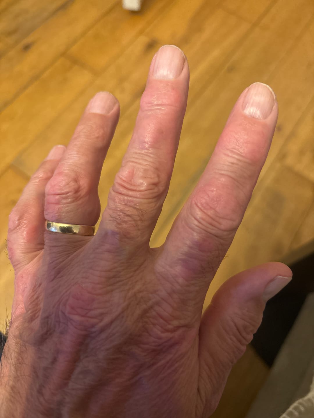 Customer photo review of Bioskin DermaSpray Intensive