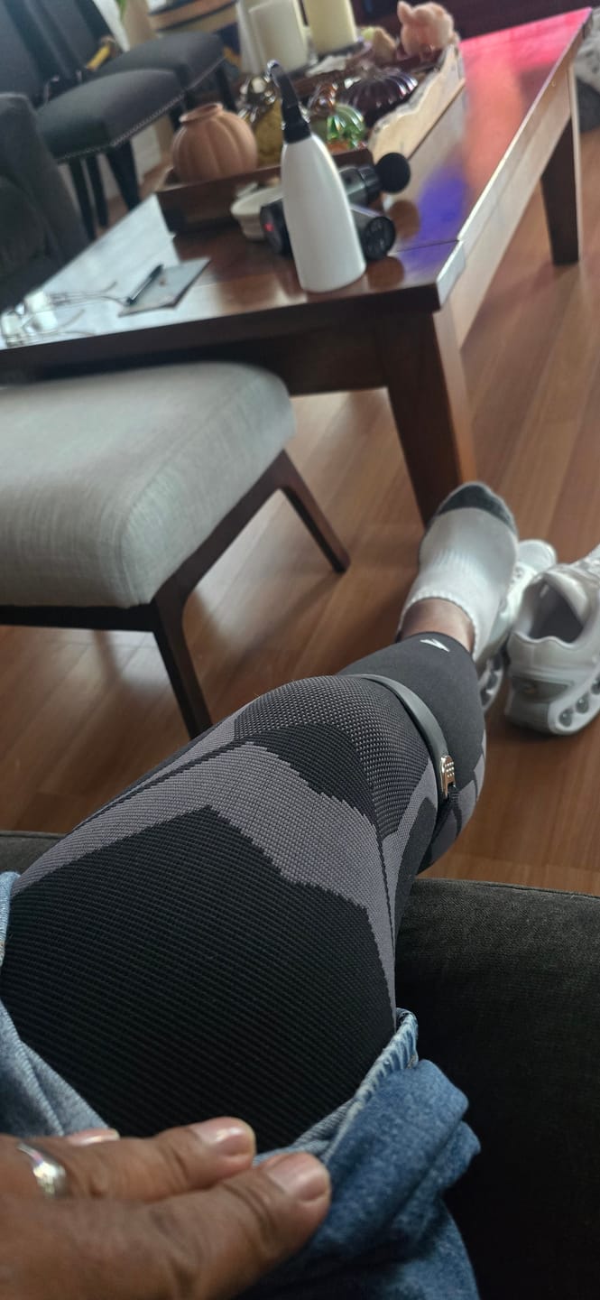 Customer photo review of Compression Sleeves V2 for Knees and Legs