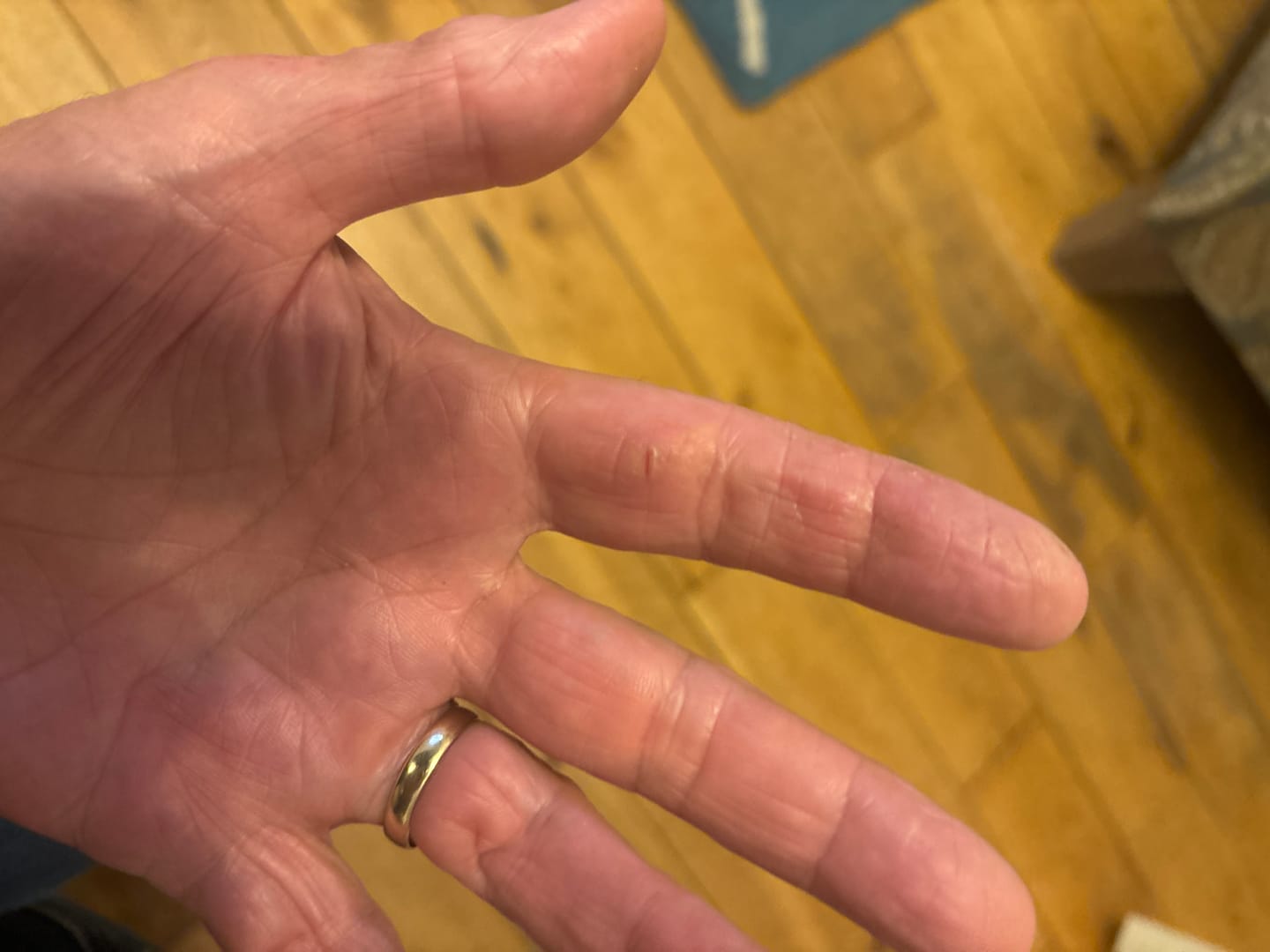 Customer photo review of Bioskin Zeoderm Skin Repair Moisturiser
