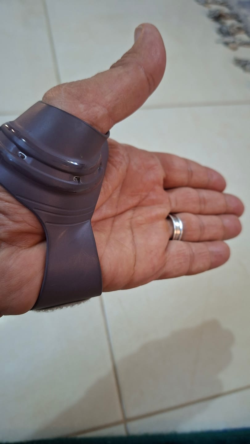 Customer photo review of Push Ortho CMC Thumb Brace – Osteoarthritis Support Splint for Thumb Joint Stabilisation
