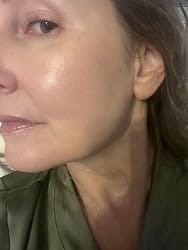 Customer photo review of AgeShield™ Face Sunscreen