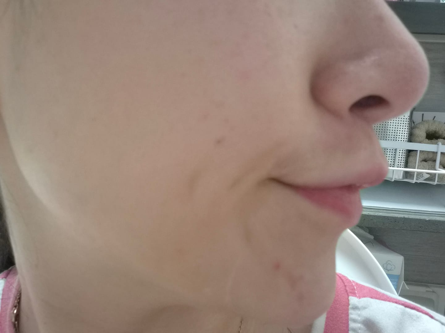 Customer photo review of Tender Garden Skin Renewal PDRN Dual Boosting Set 90ml