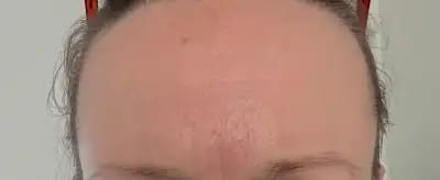 Customer photo review of PDRN Collagen Volume Balm