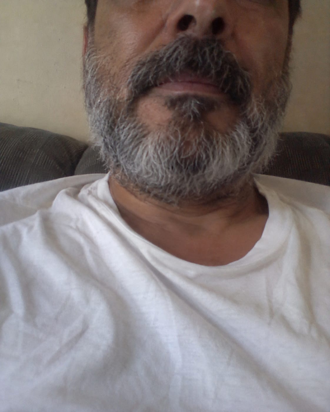 Customer photo review of Crema calmante anti-picor