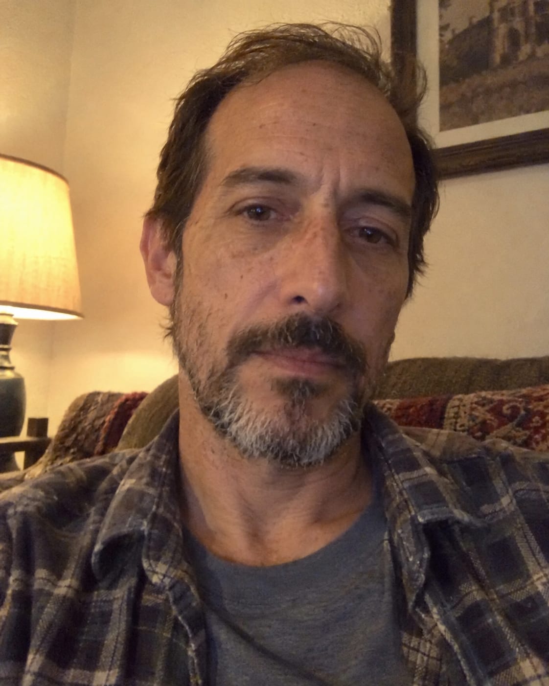 Customer photo review of Crema calmante anti-picor