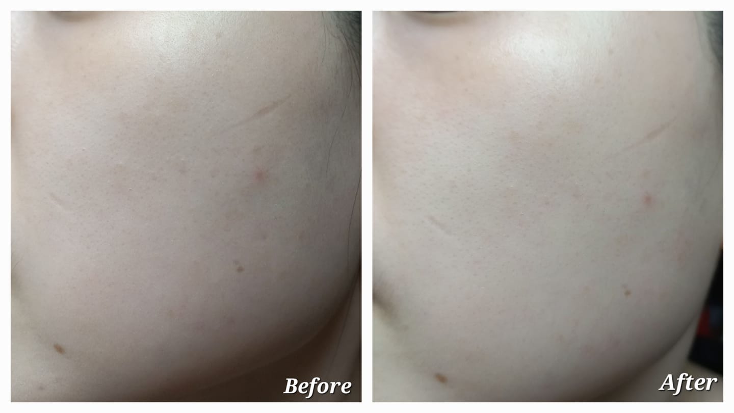 Customer photo review of Tender Garden Skin Renewal PDRN Dual Boosting Set 90ml