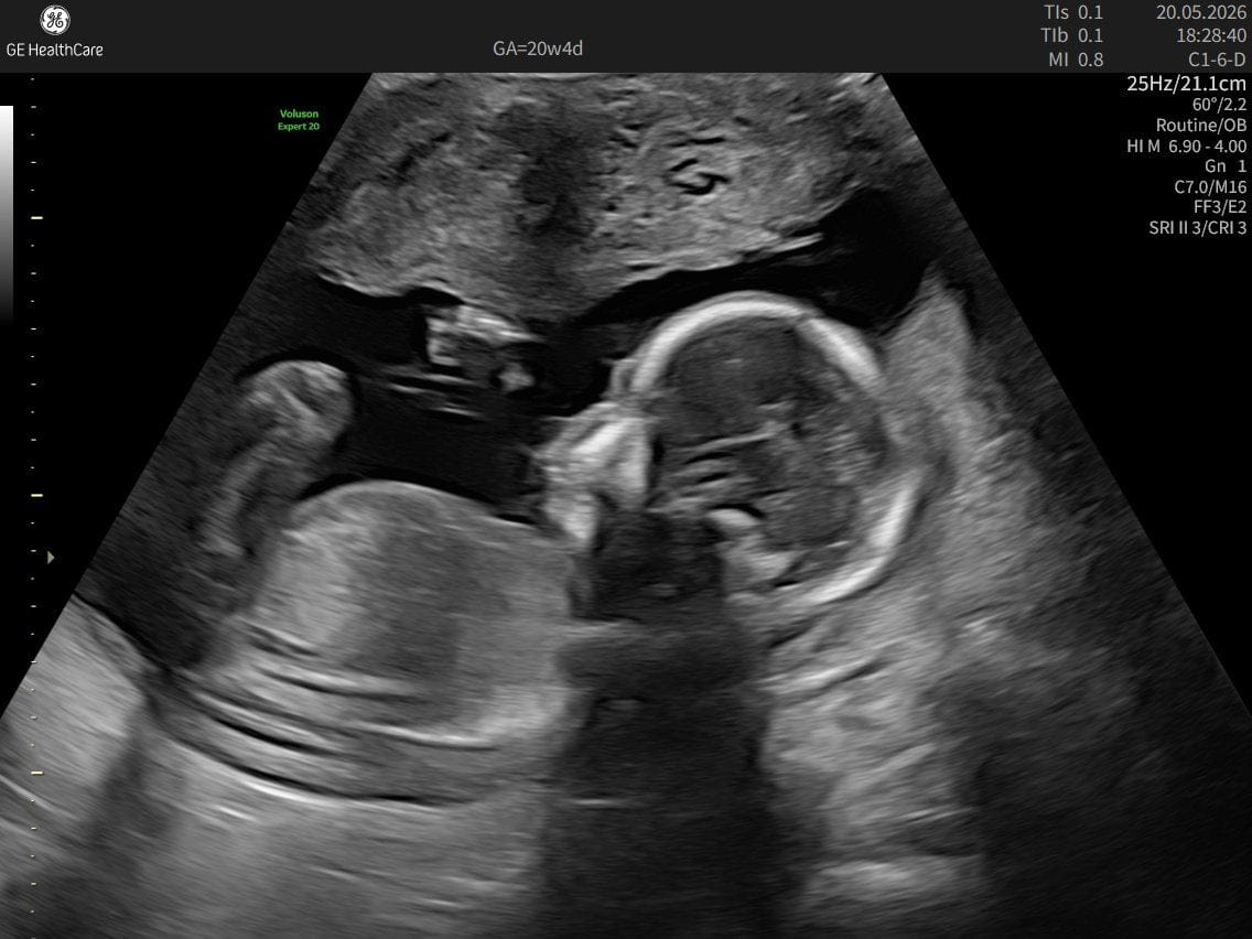 Customer photo review of Liposomal Pregnancy Support Formula