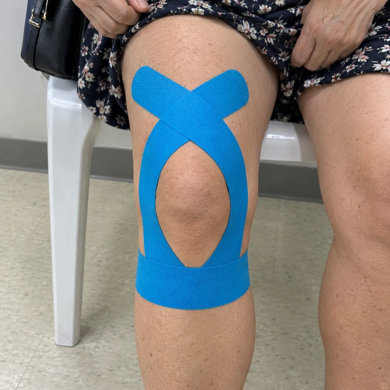 Customer photo review of APRIS Relief-Cut™ Knee Tape