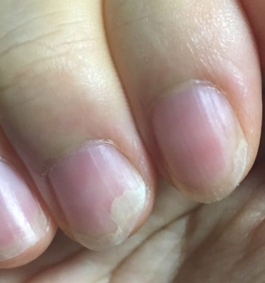 Customer photo review of baronsie Ectoin Lotion 200ml