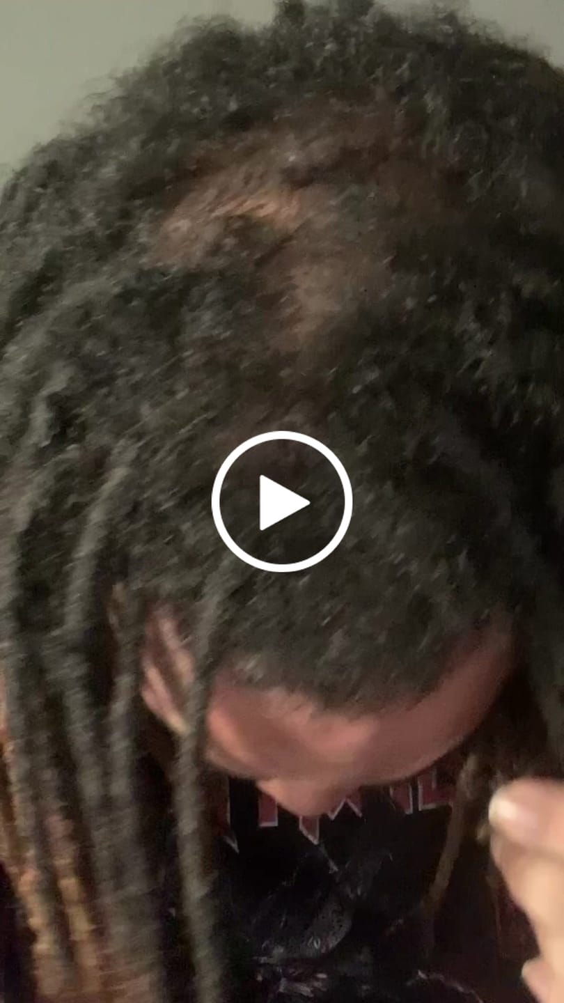 Customer video review of Men’s Healthy Hair & Beard Starter Kit