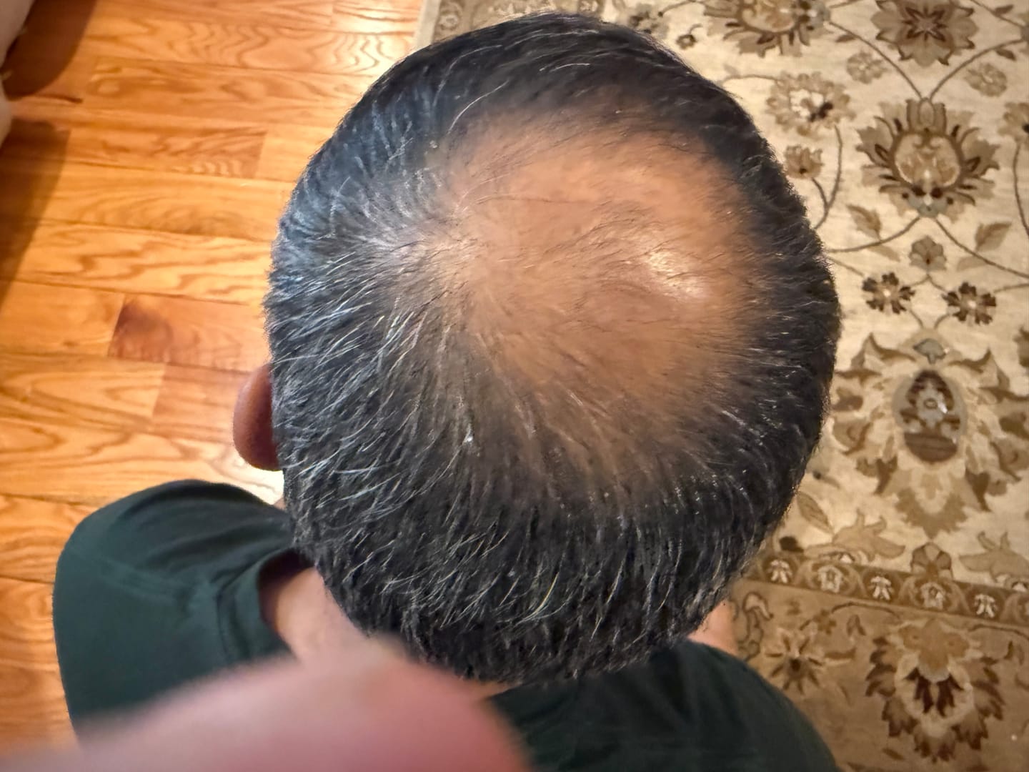 Customer photo review of Spartan™ Root Activator Shampoo 1 Bottle + Shipping(sc)