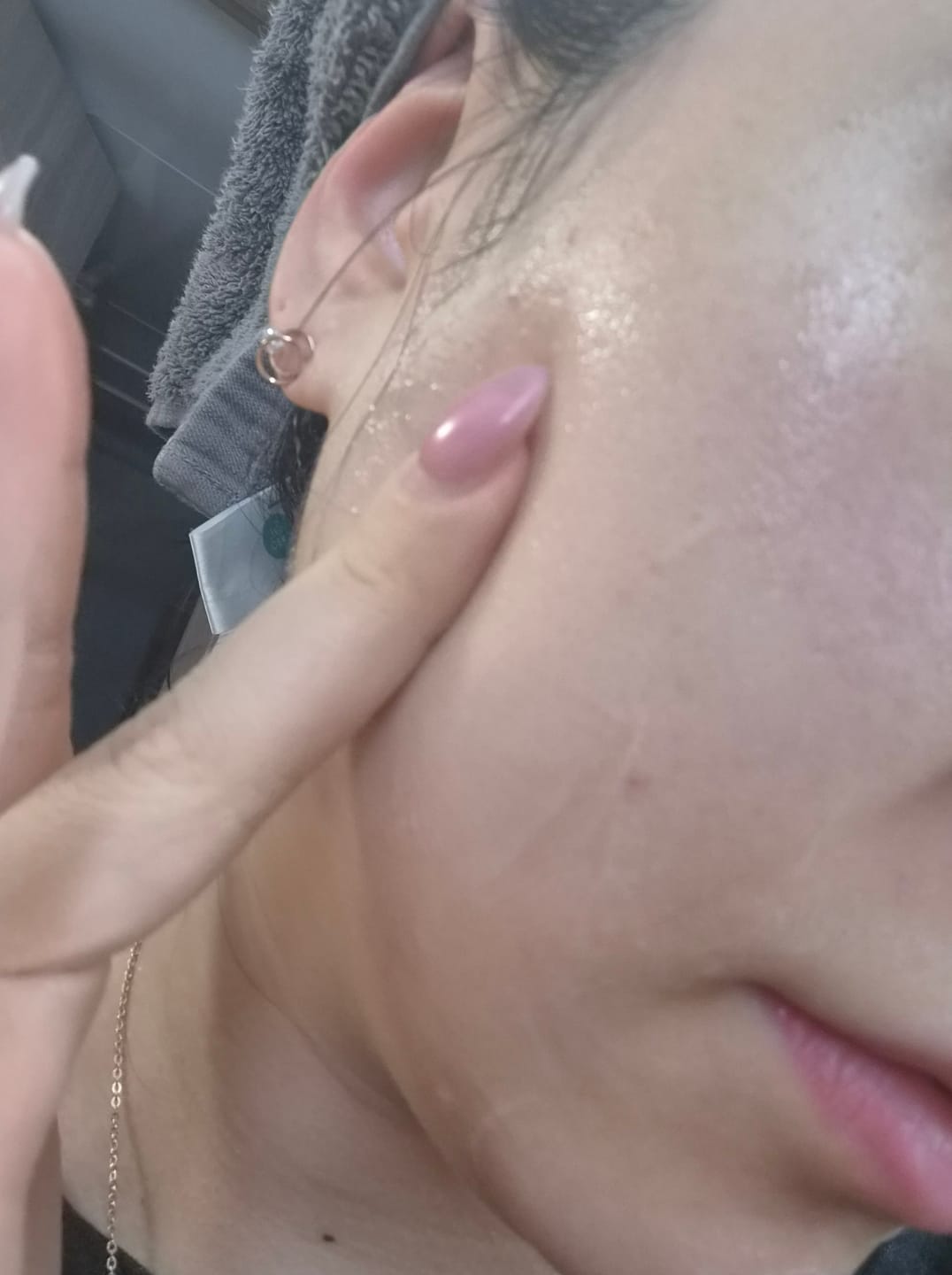 Customer photo review of Tender Garden Skin Renewal PDRN Dual Boosting Set 90ml