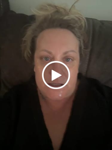 Customer photo review of Quia Turmeric & Kojic Acid Overnight Mask