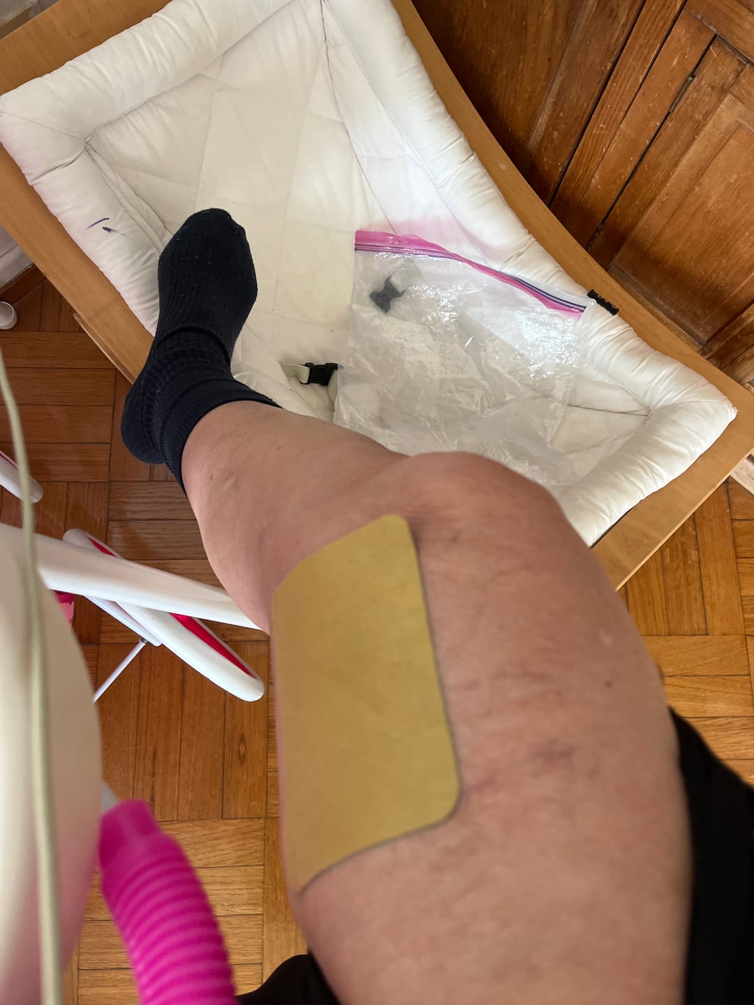 Customer photo review of Parches para Piernas Ligeras y Descansadas | Elimina Várices y Arañitas
