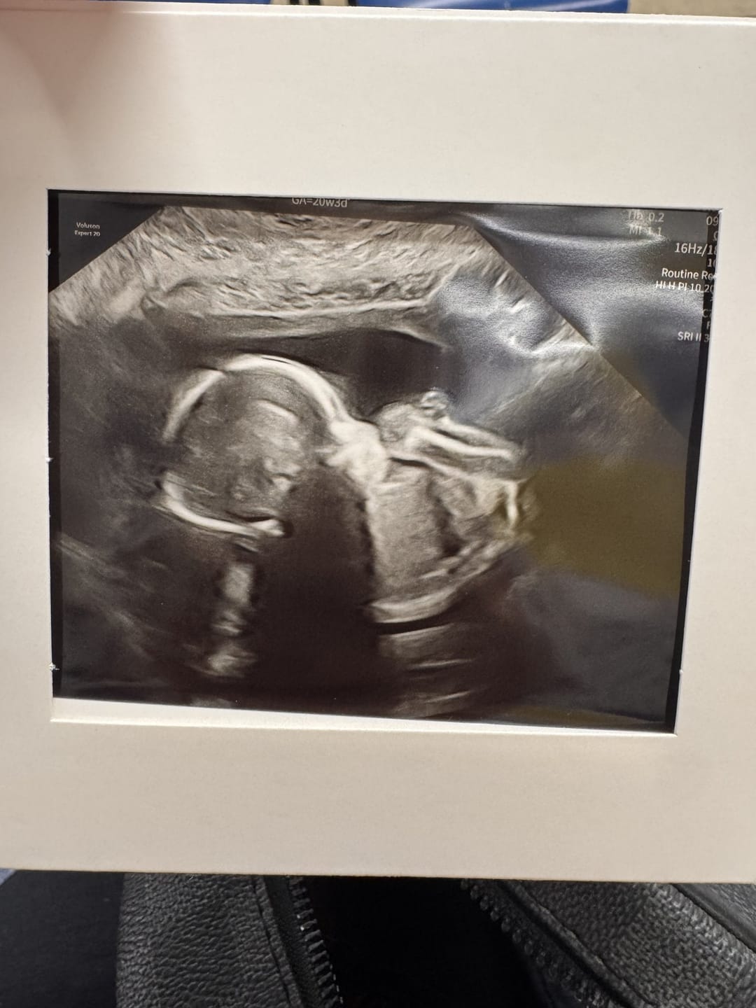 Customer photo review of Liposomal Pregnancy Support Formula