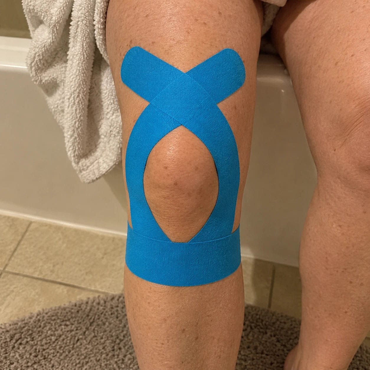 Customer photo review of APRIS Relief-Cut™ Knee Tape