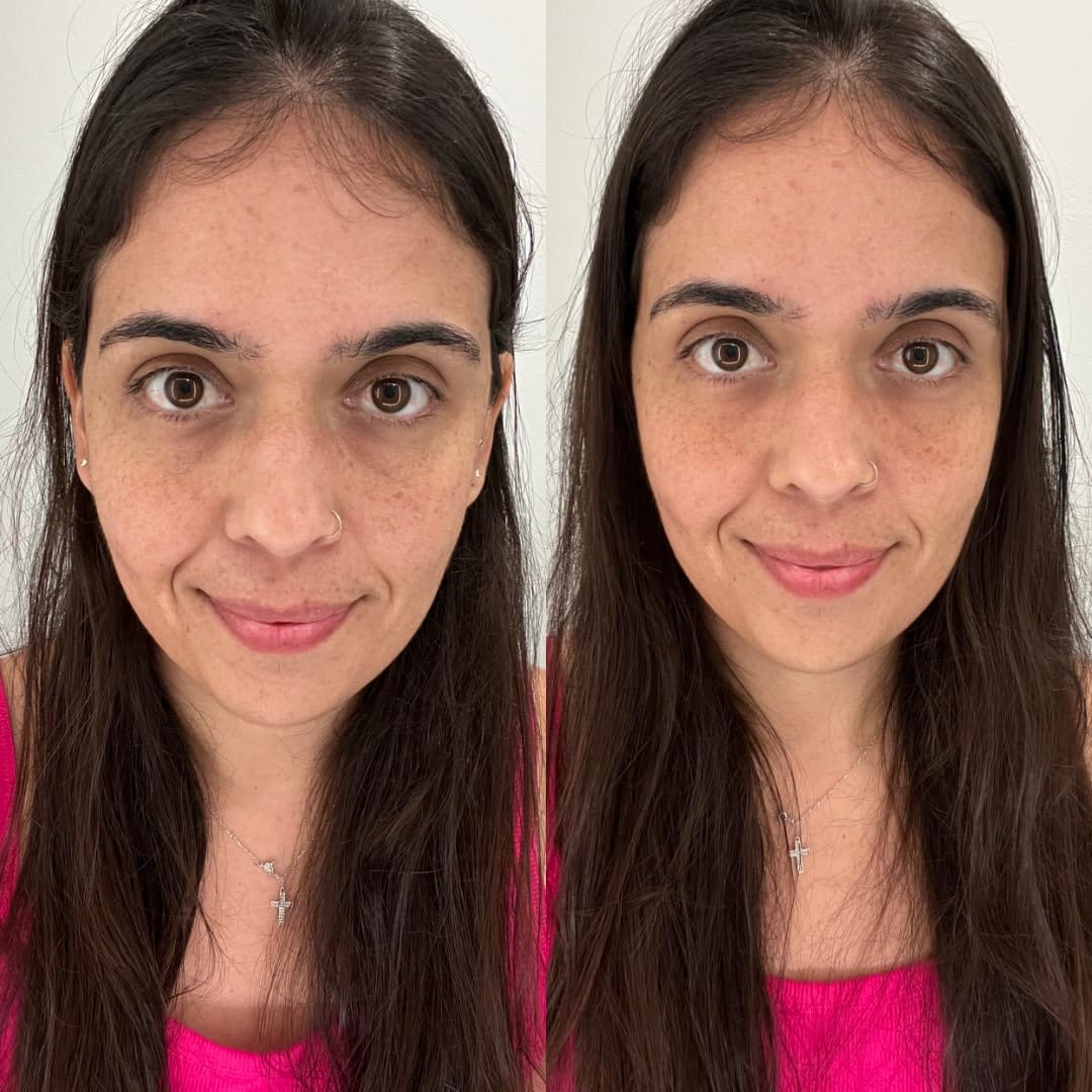 Customer photo review of NoaPure Instant Eye Lift Gel | Göz Çevresi Bakım Jeli