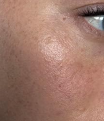 Customer photo review of AgeShield™ Face Sunscreen