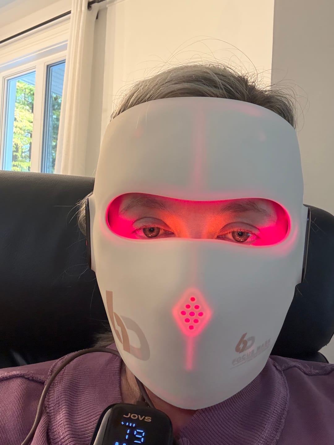 Customer photo review of JOVS 6D Laser & EMS Anti-Aging Therapy Mask