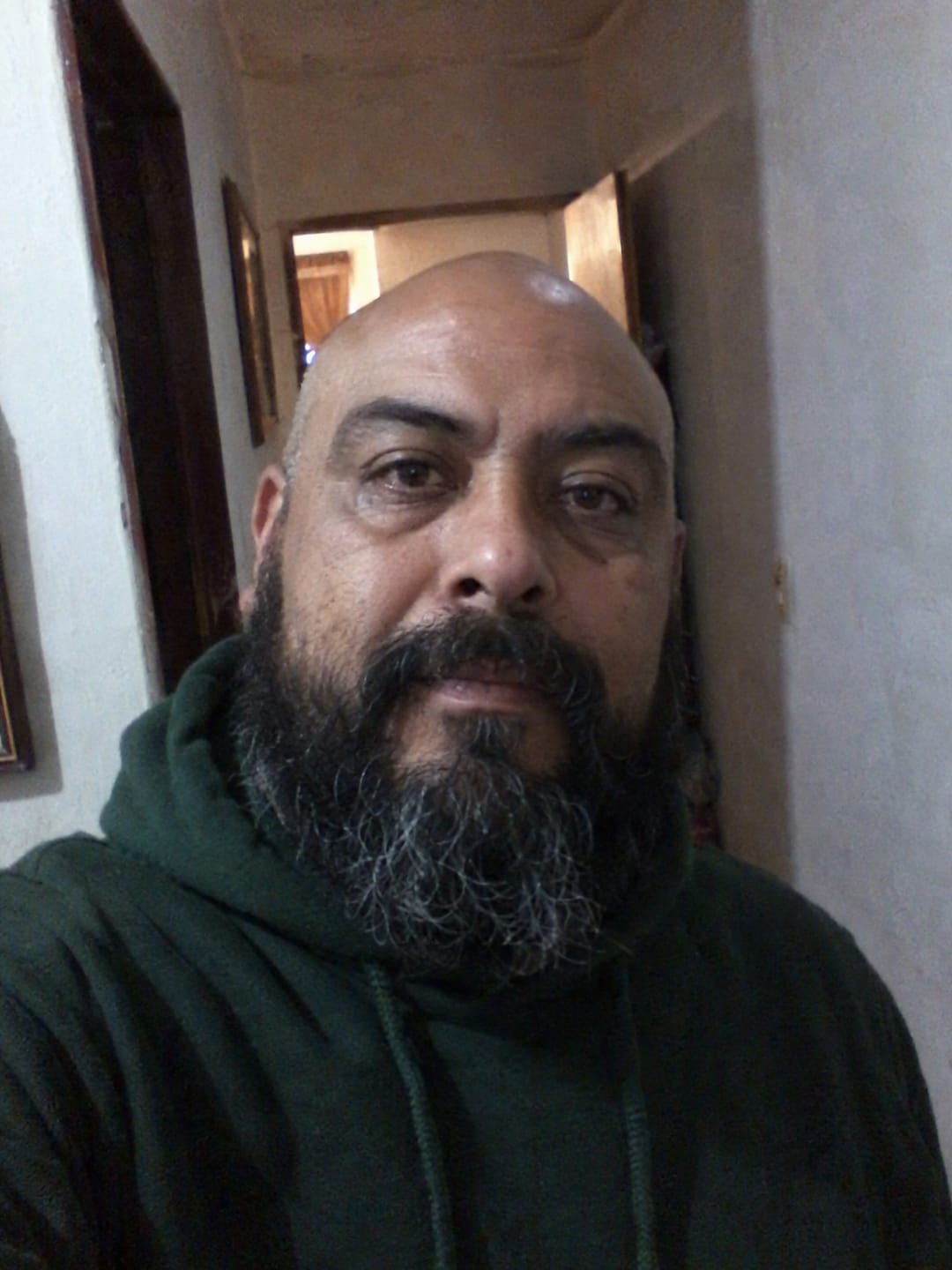 Customer photo review of Crema calmante anti-picor