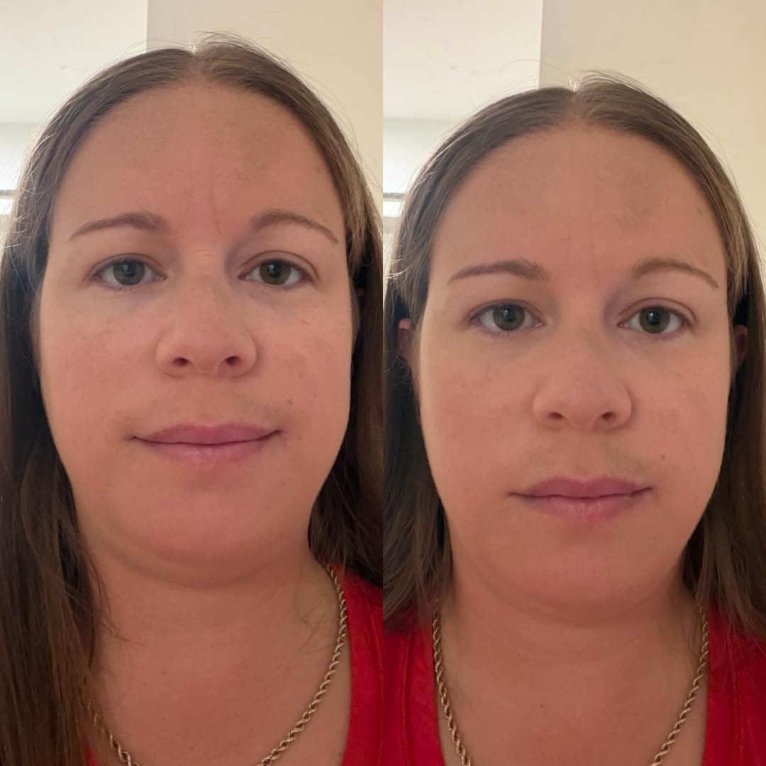 Customer photo review of NoaPure Instant Eye Lift Gel | Göz Çevresi Bakım Jeli
