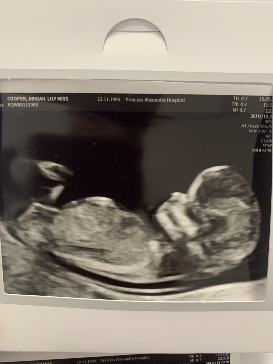 Customer photo review of Liposomal Pregnancy Support Formula