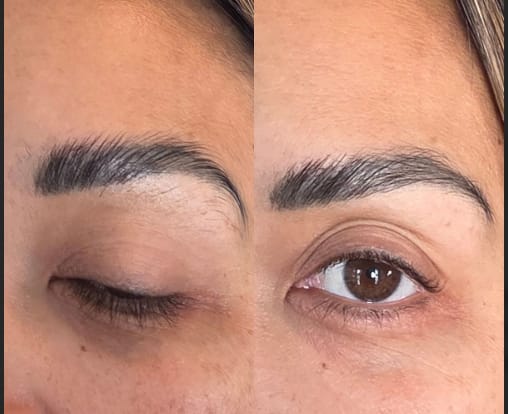 Customer photo review of Eye Roller | Eliminates Dark Circles & Puffy Eyes