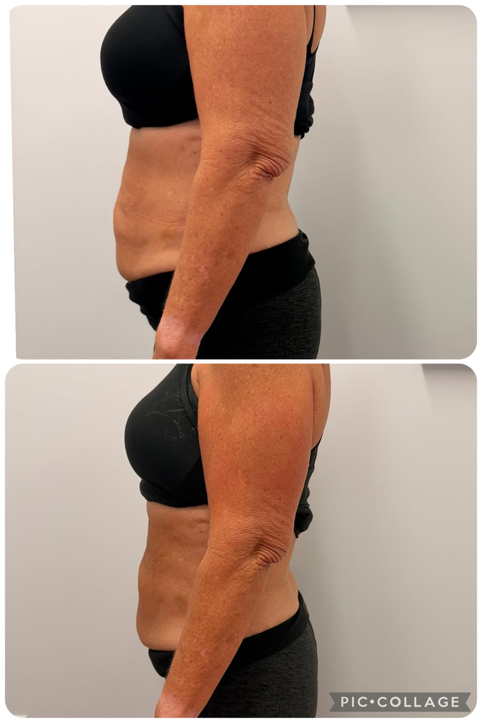 Customer photo review of Eris® Lipo Cavitation Machine 9 in 1 Professional