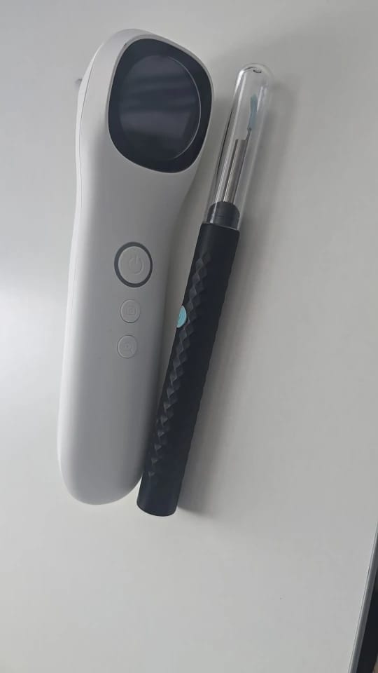 Customer photo review of AllAboutEars – 1080P Connected Otoscope, WiFi Ear Camera (iOS & Android)