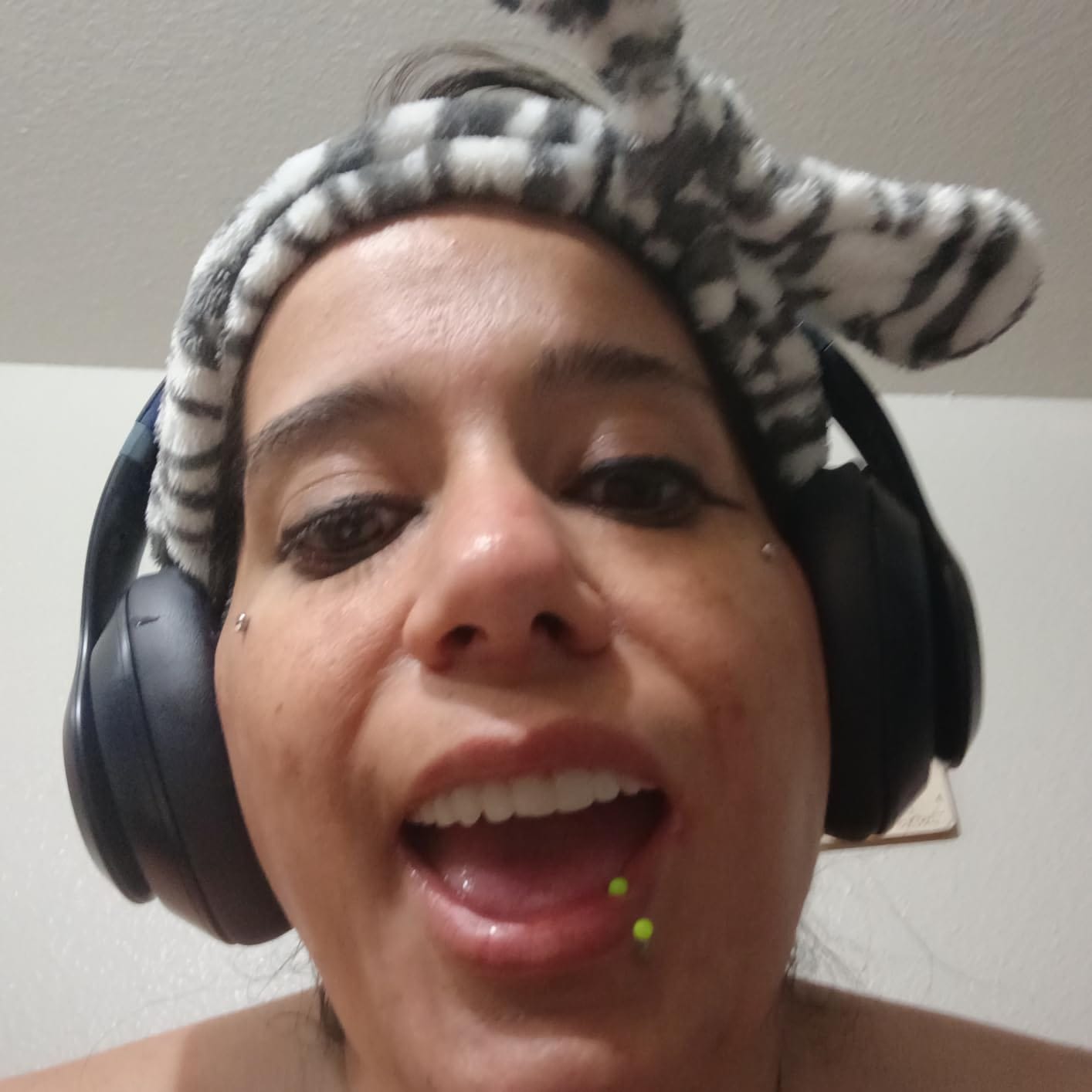 Customer photo review of Boil-And-Bite Medical-Grade Denture Set (Upper & Lower)