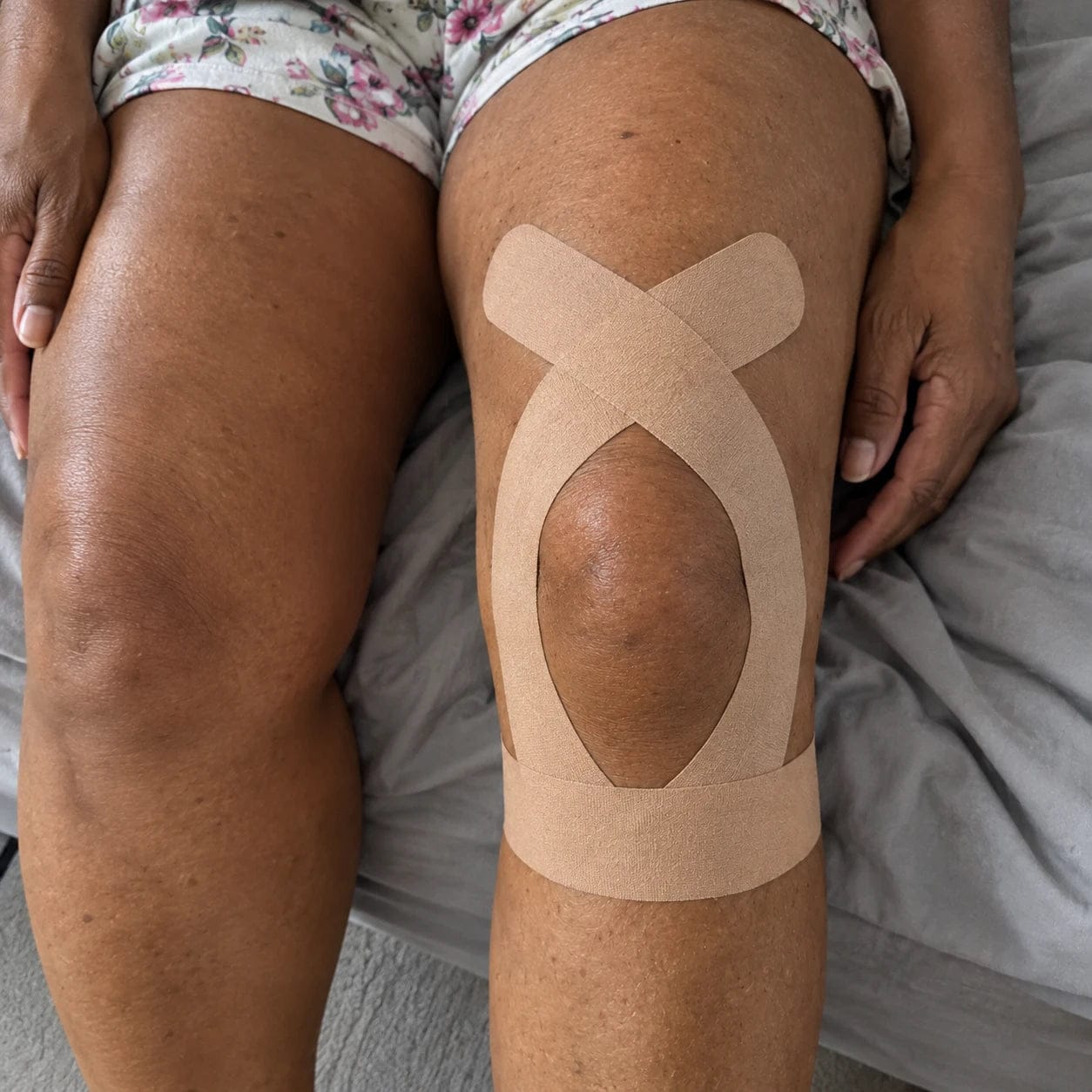 Customer photo review of APRIS Relief-Cut™ Knee Tape