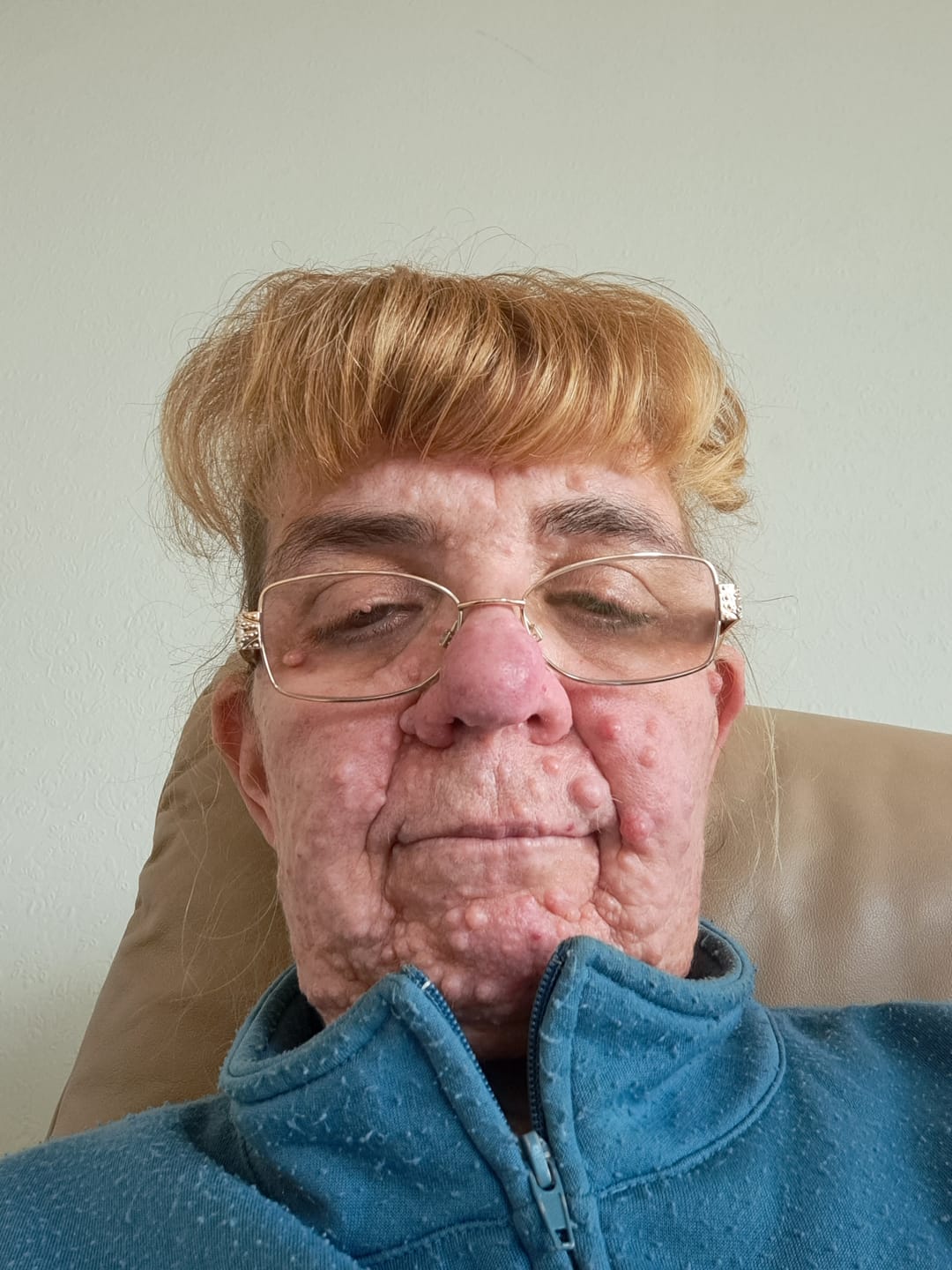 Customer photo review of Rosalique Redness Relief Day Cream