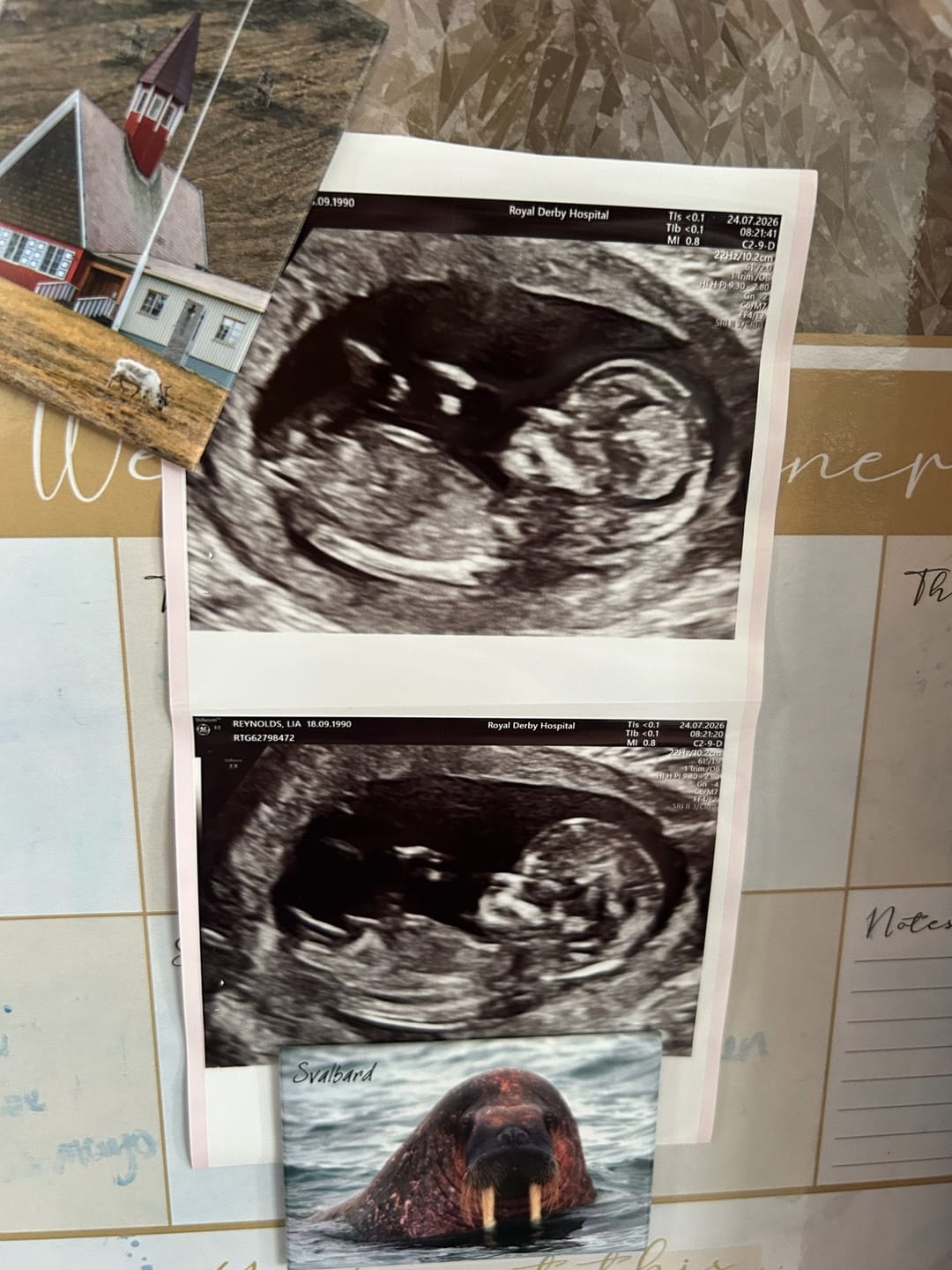 Customer photo review of Liposomal Pregnancy Support Formula