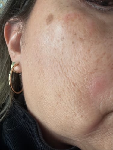 Customer photo review of Quia Turmeric & Kojic Acid Overnight Mask