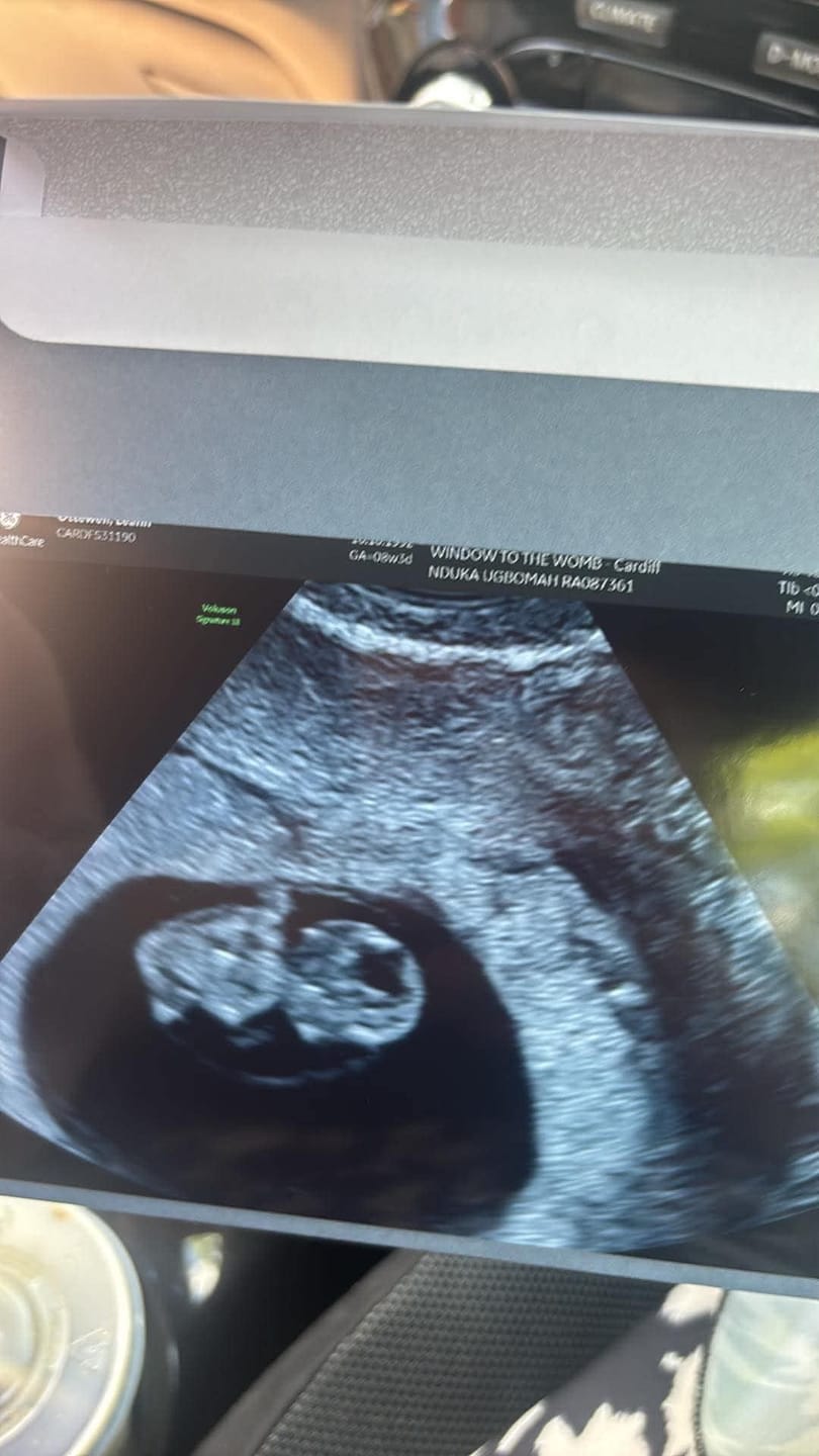 Customer photo review of Liposomal Pregnancy Support Formula
