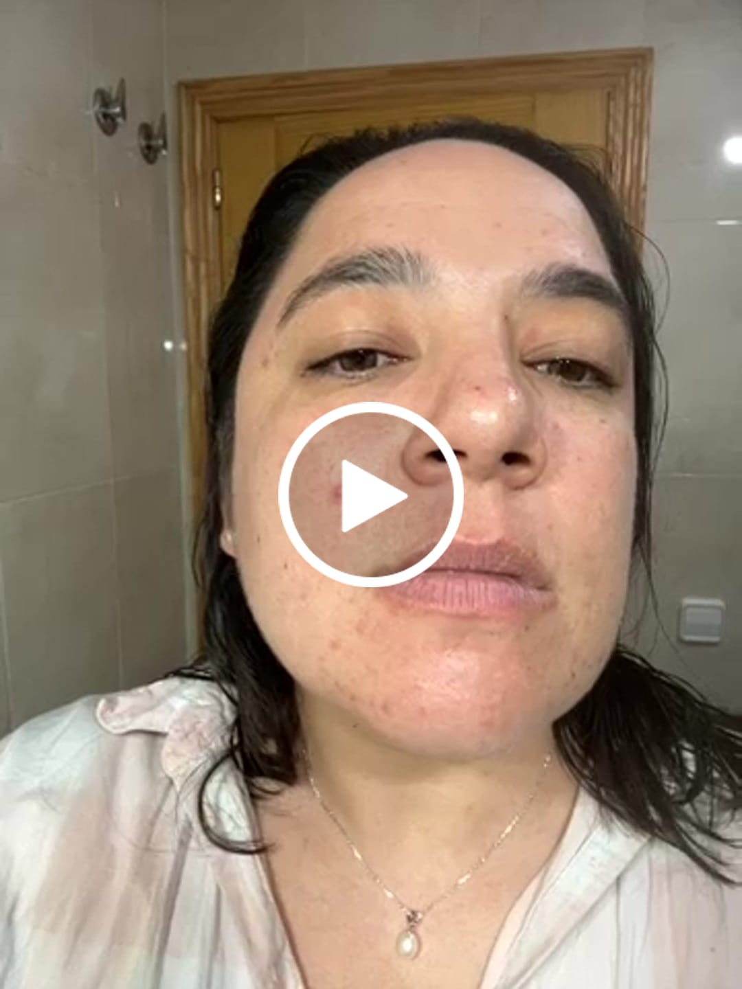 Customer video review of A CONTROL - ACNÉ HORMONAL & RESISTENCIA A LA INSULINA