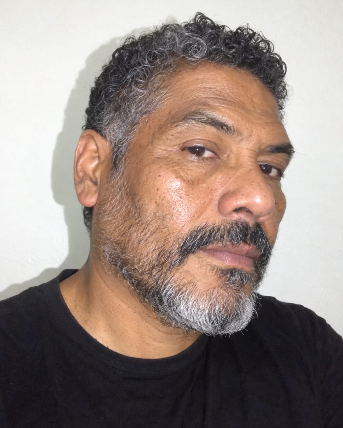 Customer photo review of Crema calmante anti-picor