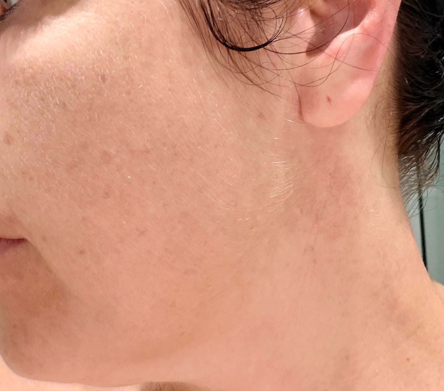 Customer photo review of Sea Buckthorn Serum - 30ml