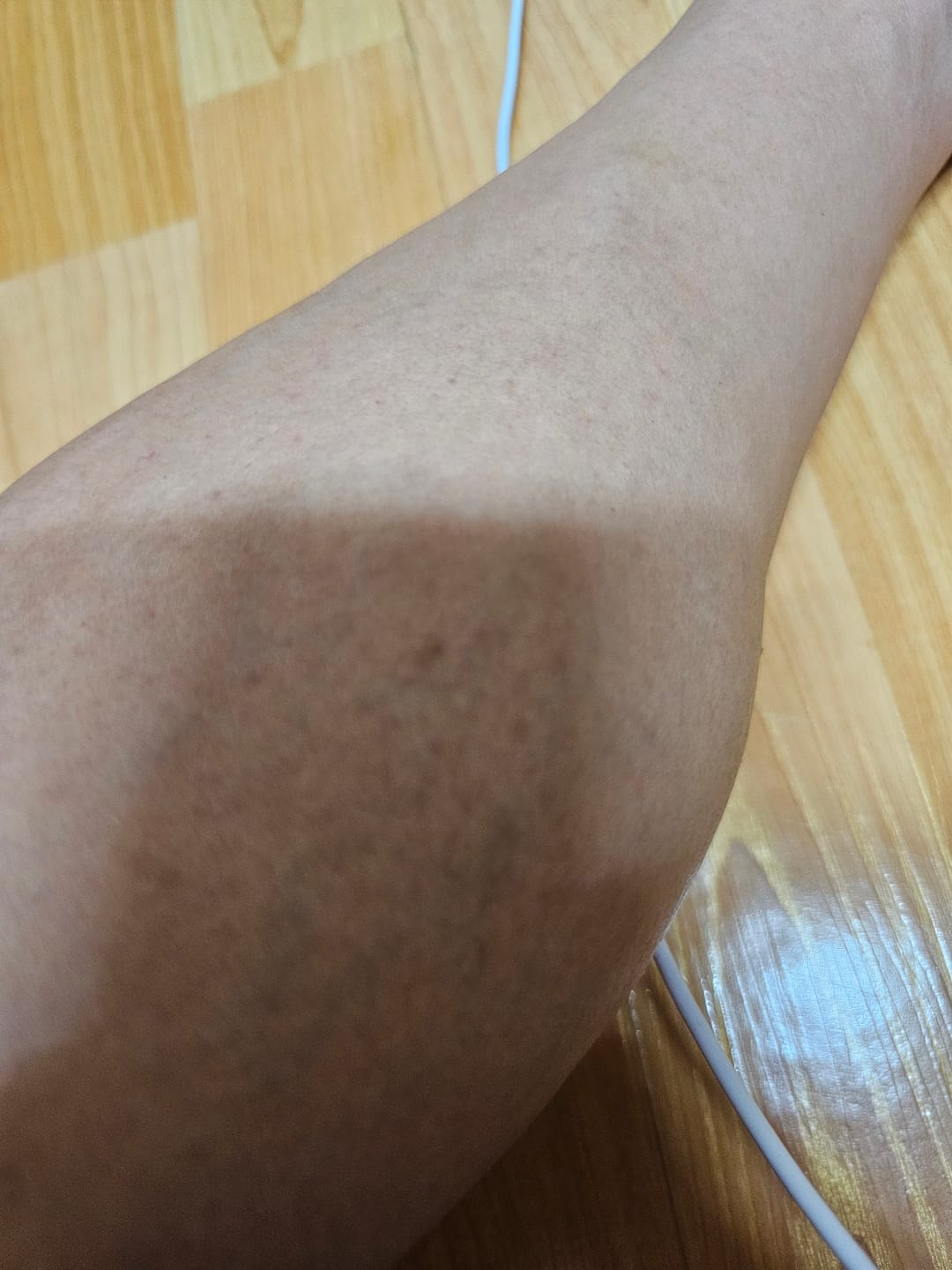 Customer photo review of papasoap Deep Clean Blemish-Care Bar 100g