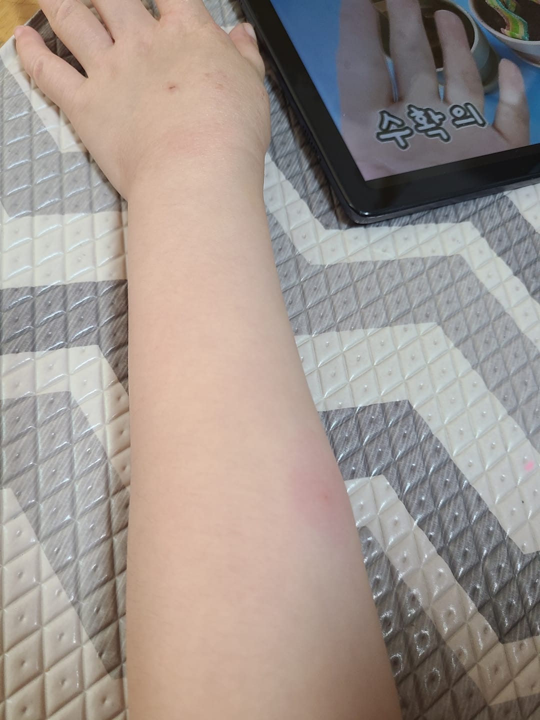 Customer photo review of baronsie Ectoin Lotion 200ml