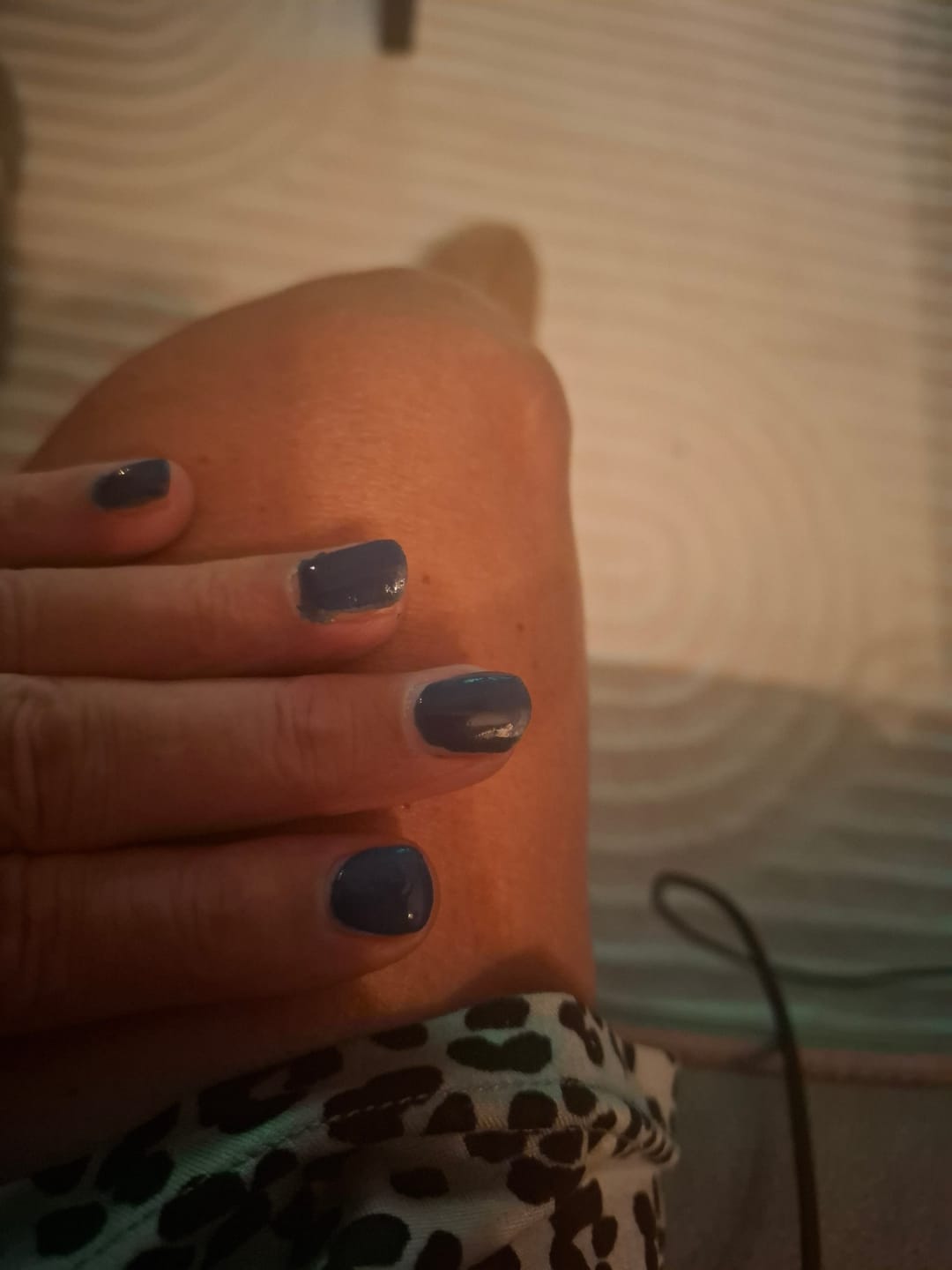 Customer photo review of Glowdip Alles-in-één Manicure Set