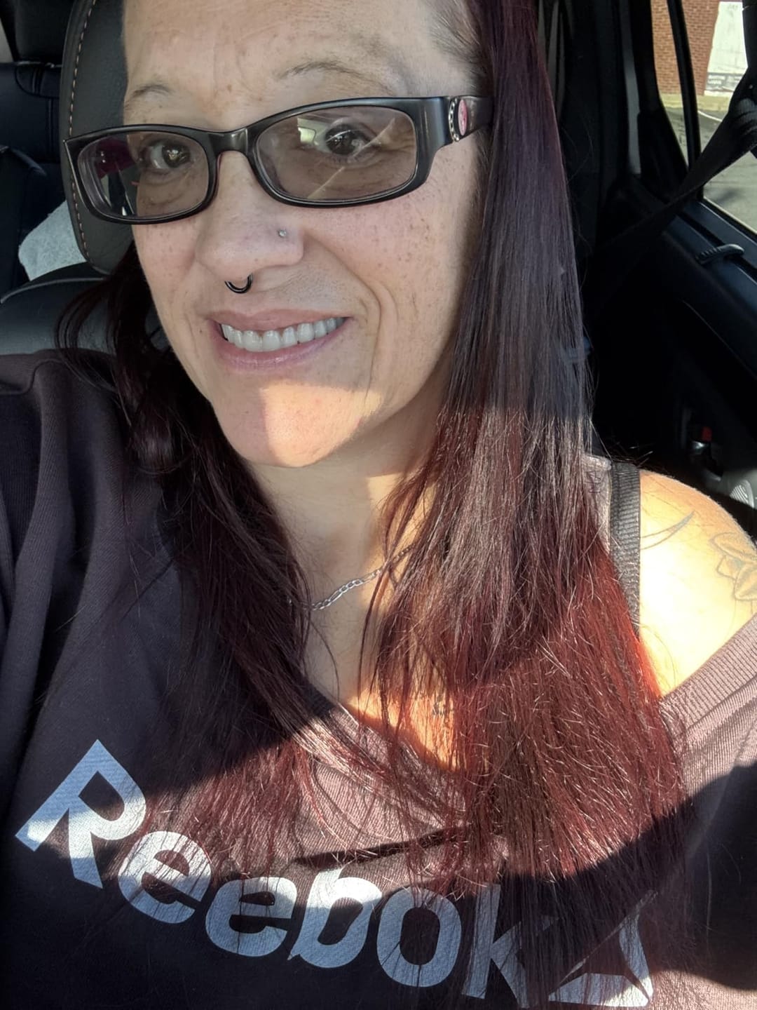 Customer photo review of Boil-And-Bite Medical-Grade Denture Set (Upper & Lower)